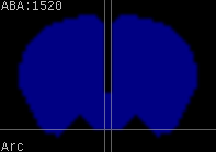 ABA expression energy