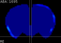 ABA expression energy