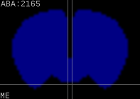 ABA expression energy