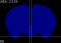 ABA expression energy
