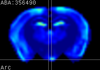 ABA expression energy