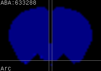 ABA expression energy