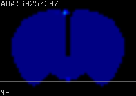 ABA expression energy