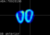 ABA expression energy