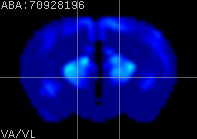 ABA expression energy