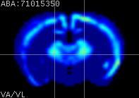 ABA expression energy