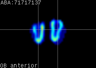 ABA expression energy