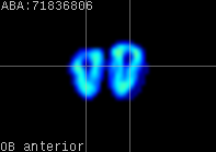 ABA expression energy