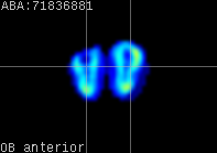 ABA expression energy