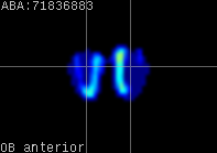 ABA expression energy