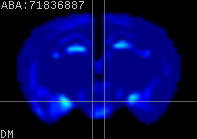ABA expression energy