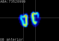 ABA expression energy