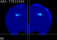 ABA expression energy