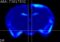 ABA expression energy
