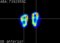 ABA expression energy