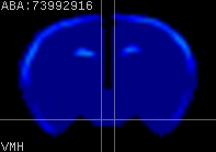 ABA expression energy