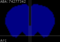 ABA expression energy