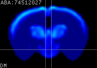 ABA expression energy