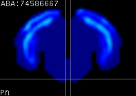 ABA expression energy