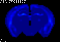 ABA expression energy