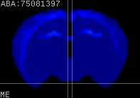ABA expression energy