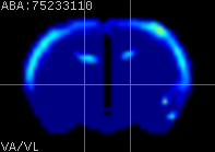 ABA expression energy