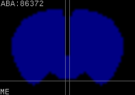 ABA expression energy