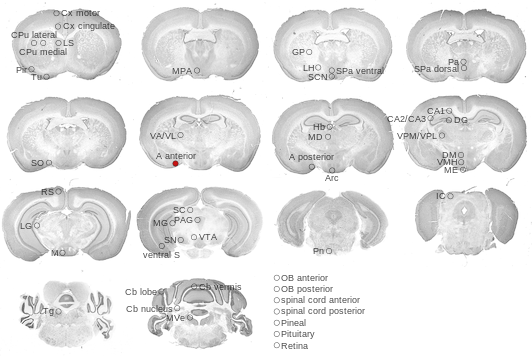 Coronal sections