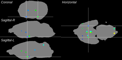 3D Cross section