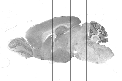 Sagittal sections