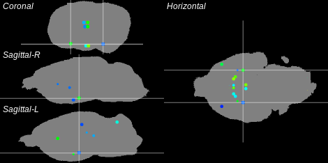 3D Cross section