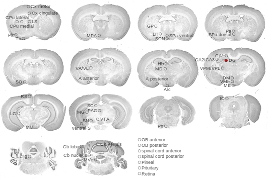 Coronal sections