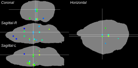 3D Cross section