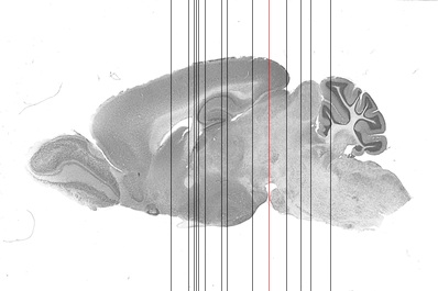 Sagittal sections