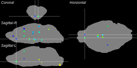 3D Cross section