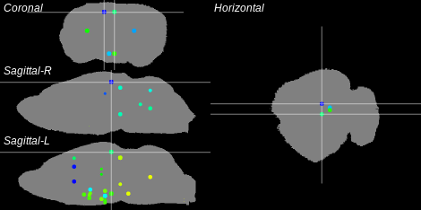 3D Cross section