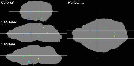 3D Cross section