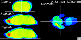 ViBrism