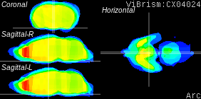 ViBrism
