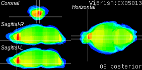 ViBrism