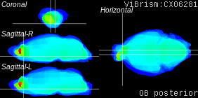 ViBrism