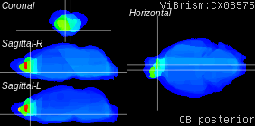 ViBrism