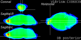 ViBrism