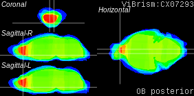 ViBrism