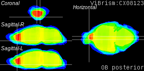 ViBrism