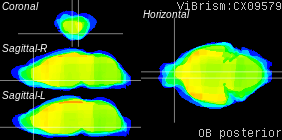 ViBrism