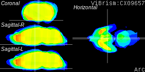 ViBrism