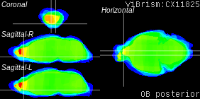 ViBrism