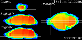 ViBrism