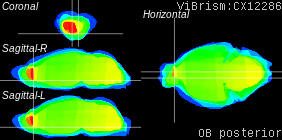 ViBrism